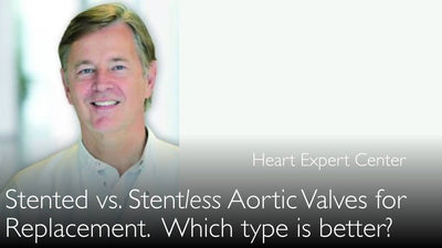 Aortenklappenersatz. Aortenklappen mit oder ohne Stent? 6