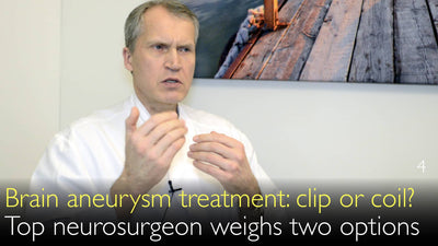 Behandlung von Hirnaneurysma. Clip, Spule oder Stent? Wie wählt man die beste Therapie für intrakraniale Aneurysmen? 4